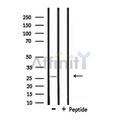 UBTD2 Antibody - Western blot analysis of extracts from rat heart, using UBTD2 Antibody.