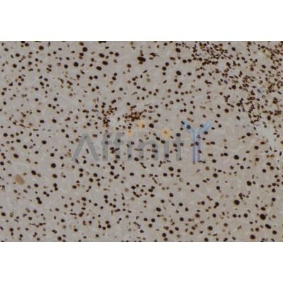 TGIF2LY Antibody - DF8751 at 1/100 staining Mouse liver tissue by IHC-P.
