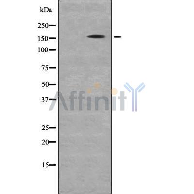 Gli3 Antibody - Western blot analysis GLI-3 using K562 whole cell lysates.