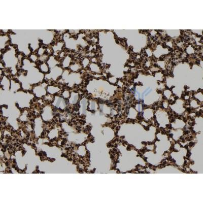 ENTK Antibody - DF8811 at 1/100 staining Mouse lung tissue by IHC-P.