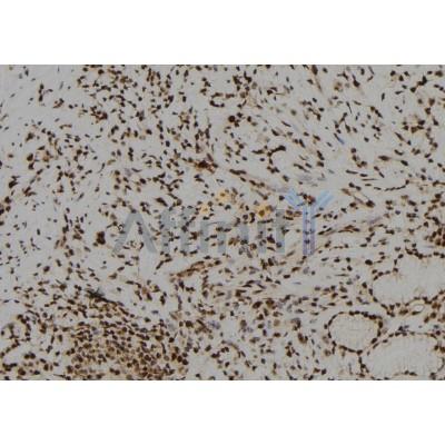 Basonuclin Antibody - DF8812 at 1/100 staining Human gastric tissue by IHC-P.