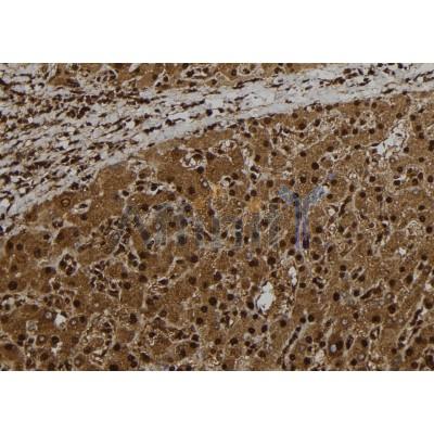 CT47A Antibody - DF8837 at 1/100 staining Human liver tissue by IHC-P.