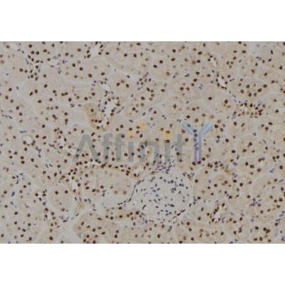 GTF2H4 Antibody - DF8857 at 1/100 staining Rat kidney tissue by IHC-P.