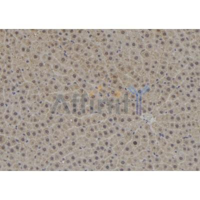 TPD52L3 Antibody - DF8860 at 1/100 staining Rat liver tissue by IHC-P.