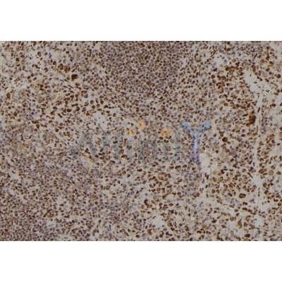 APOBEC3C Antibody - DF8876 at 1/100 staining Mouse spleen tissue by IHC-P.