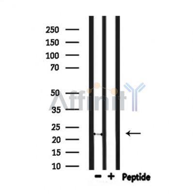 FGF20 Antibody - Western blot analysis of extracts from mouse brain, using FGF20 Antibody.