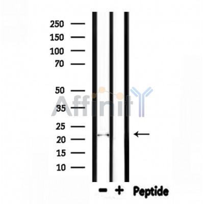FGF6 Antibody - Western blot analysis of extracts from mouse liver, using FGF6 Antibody.