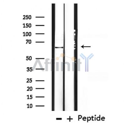 K2C3 Antibody - Western blot analysis of extracts from mouse brain, using K2C3 Antibody.