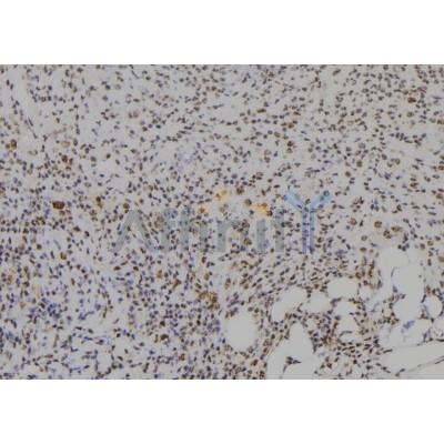 CIDEA Antibody - DF9053 at 1/100 staining Human spleen tissue by IHC-P.