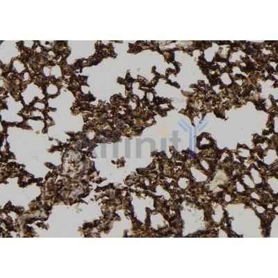 NKIRAS1 Antibody - DF9067 at 1/100 staining Mouse lung tissue by IHC-P.