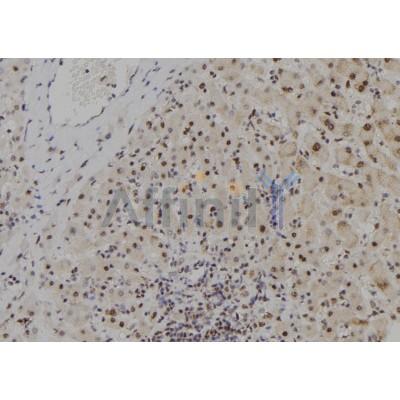MYCNOS Antibody - DF9068 at 1/100 staining Human liver tissue by IHC-P.