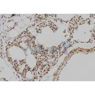 POU3F3 Antibody - DF9088 at 1/100 staining Rat lung tissue by IHC-P.