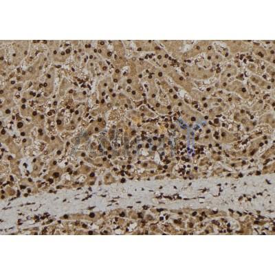 ADAM33 Antibody - DF9166 at 1/100 staining Human liver tissue by IHC-P.