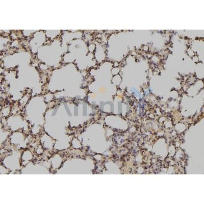 ATXN7L3 Antibody - DF9235 at 1/100 staining Mouse lung tissue by IHC-P.