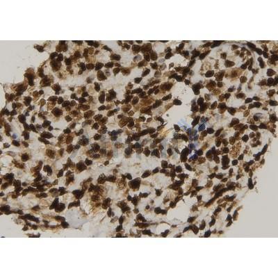 CIB4 Antibody - DF9295 at 1/100 staining Human spleen tissue by IHC-P.
