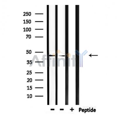 CEACAM16 Antibody - Western blot analysis of extracts from mouse brain, mouse lung, using CEACAM16 Antibody.
