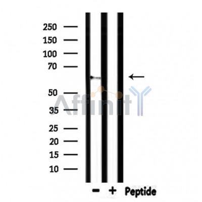 CEACAM20 Antibody - Western blot analysis of extracts from mouse lung, using CEACAM20 Antibody.