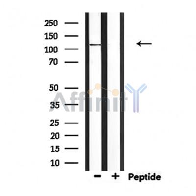 CEP110 Antibody - Western blot analysis of extracts from mouse lung, using CEP110 Antibody.