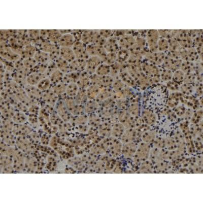 CDR1 Antibody - DF9368 at 1/100 staining Mouse kidney tissue by IHC-P.