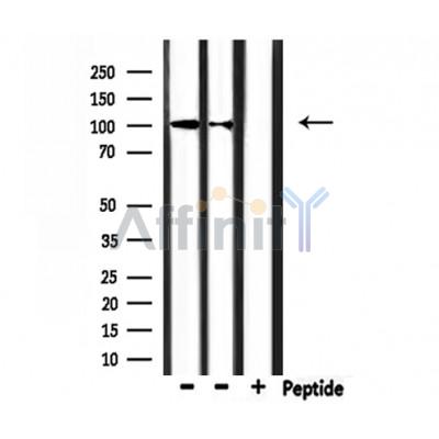 CHSY3 Antibody - Western blot analysis of extracts from rat brain, mouse brain, using CHSY3 Antibody.