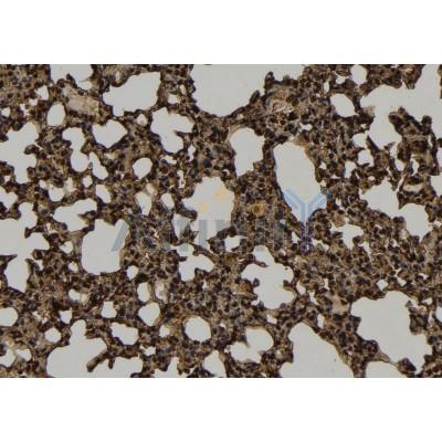 KIF4B Antibody - DF9385 at 1/100 staining Mouse lung tissue by IHC-P.