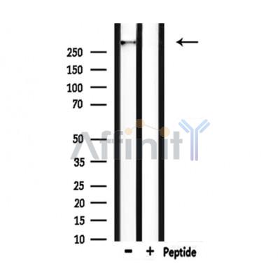 HECTD1 Antibody - Western blot analysis of extracts from rat brain, using HECTD1 Antibody.
