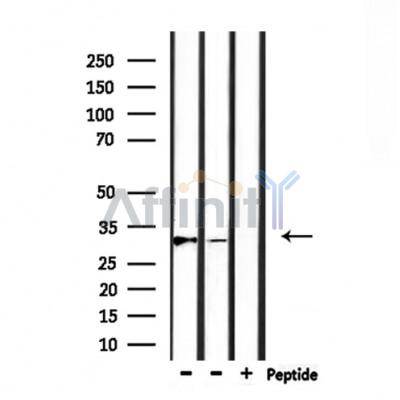 MARCH1 Antibody - Western blot analysis of extracts from rat muscle, mouse brain, using MARCH1 Antibody.
