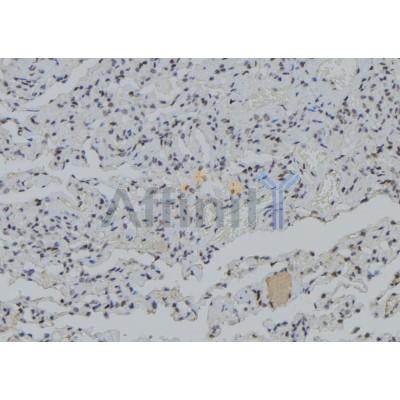 PJA1 Antibody - DF9487 at 1/100 staining Human lung tissue by IHC-P.