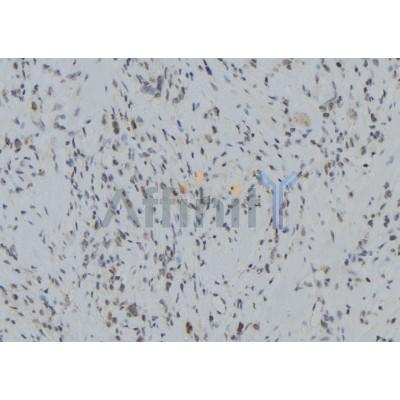 RNF123 Antibody - DF9488 at 1/100 staining Human gastric tissue by IHC-P.