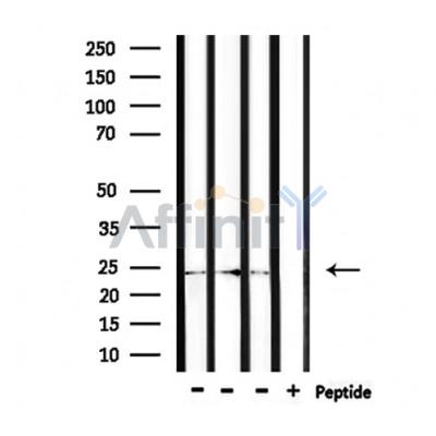 ZNRF1 Antibody - Western blot analysis of extracts from rat brain, rat muscle, mouse brain, using ZNRF1 Antibody.