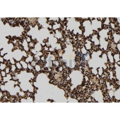 GPATCH8 Antibody - DF9522 at 1/100 staining Mouse lung tissue by IHC-P.