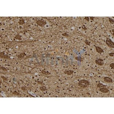 GON4L Antibody - DF9537 at 1/100 staining Rat brain tissue by IHC-P.