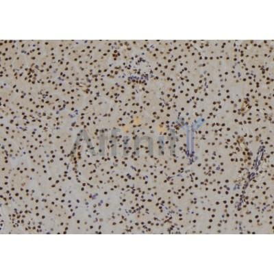 SIX3 Antibody - DF9591 at 1/100 staining Mouse kidney tissue by IHC-P.
