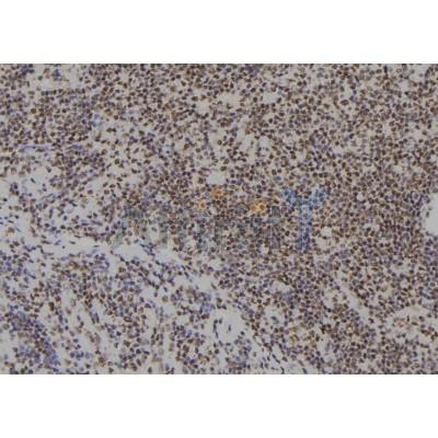 SIX4 Antibody - DF9592 at 1/100 staining Human spleen tissue by IHC-P.