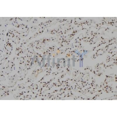 TGIF2LX Antibody - DF9593 at 1/100 staining Human lung tissue by IHC-P.