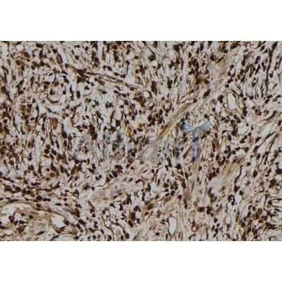 NGRN Antibody - DF9680 at 1/100 staining Human gastric tissue by IHC-P.