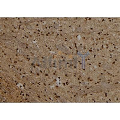PRDM10 Antibody - DF9772 at 1/100 staining Rat brain tissue by IHC-P.