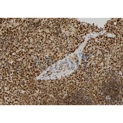 RERG Antibody - DF9811 at 1/100 staining Mouse spleen tissue by IHC-P.