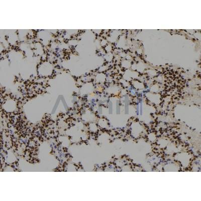RGS17 Antibody - DF9844 at 1/100 staining Mouse lung tissue by IHC-P.
