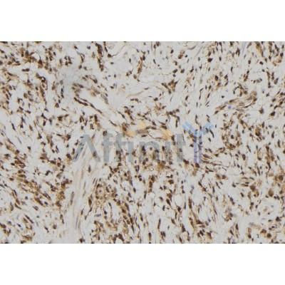 RFPL2 Antibody - DF9850 at 1/100 staining Human gastric tissue by IHC-P.