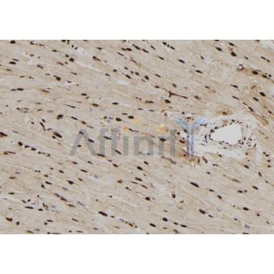 RPS6KL1 Antibody - DF9871 at 1/100 staining Rat heart tissue by IHC-P.