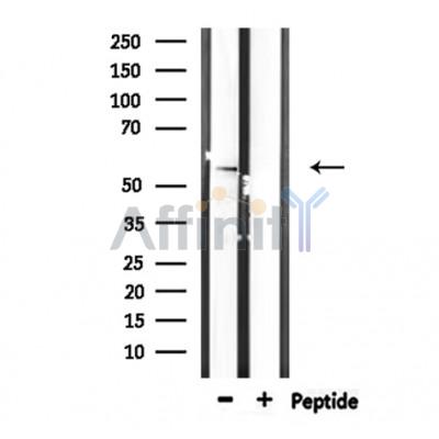 STK38L Antibody - Western blot analysis of extracts from HepG2, using STK38L Antibody.