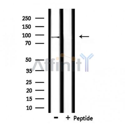 USP16 Antibody - Western blot analysis of extracts from rat brain, using USP16 Antibody.