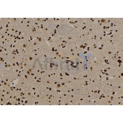 USP29 Antibody - DF9987 at 1/100 staining Rat brain tissue by IHC-P.