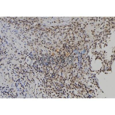 USP49 Antibody - DF9993 at 1/100 staining Human spleen tissue by IHC-P.
