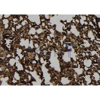 POTE-14/22 Antibody - AF9168 at 1/100 staining Mouse lung tissue by IHC-P.
