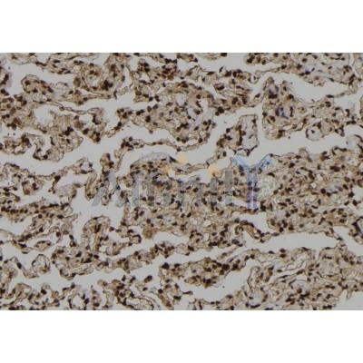 PSK-H1 Antibody - AF9170 at 1/100 staining Human lung tissue by IHC-P.