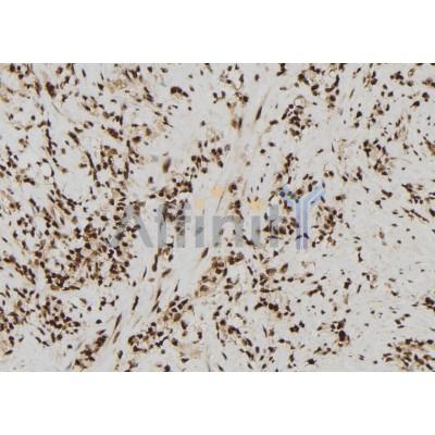 Sin3B Antibody - AF9199 at 1/100 staining Human gastric tissue by IHC-P.