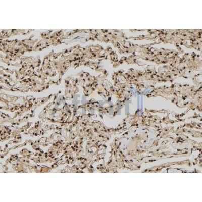 SUHW1 Antibody - AF9205 at 1/100 staining Human lung tissue by IHC-P.