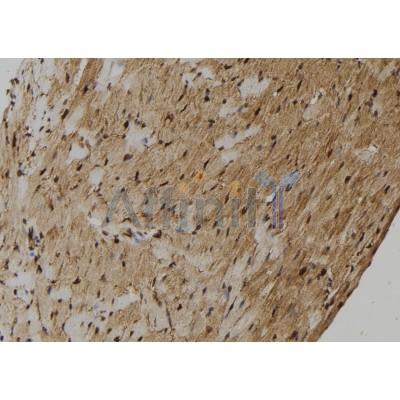 ZNF262 Antibody - AF9235 at 1/100 staining Mouse heart tissue by IHC-P.